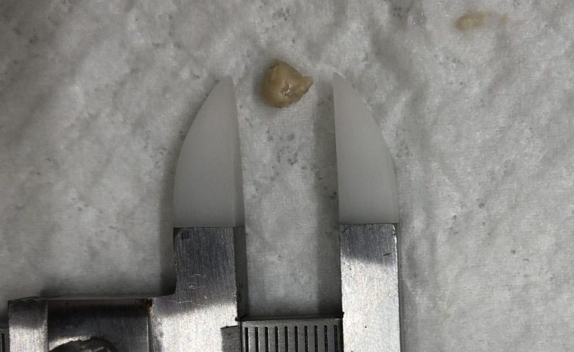カメさんの眼、腫れていませんか